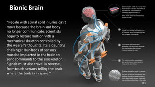 Bionic Brain
“People with spinal cord injuries can’t
move because the brain and body
no longer communicate. Scientists
hop...