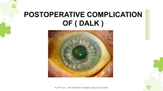 ALLPPT.com _ Free PowerPoint Templates, Diagrams and Charts
POSTOPERATIVE COMPLICATION
OF ( DALK )
 