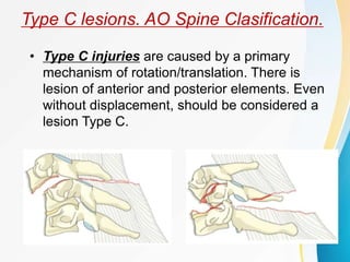 Clowards Anterior approach with Interbody fusion in a patient with AO ...