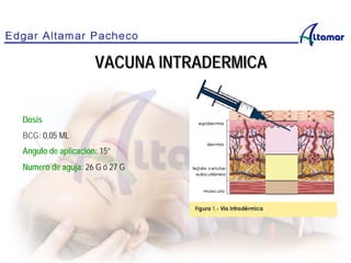 Dosis
BCG: 0,05 ML
Angulo de aplicación: 15°
Numero de aguja: 26 G ó 27 G
VACUNA INTRADERMICA
 