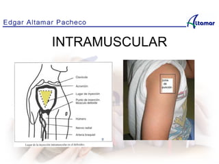 INTRAMUSCULAR
No se puede mostrar la imagen en este momento.
 