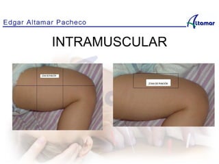 INTRAMUSCULAR
No se puede mostrar la imagen en este momento.
 