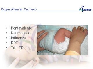 • Pentavalente
• Neumococo
• Influenza
• DPT
• Td – TD
No se puede mostrar la imagen en este momento.
 