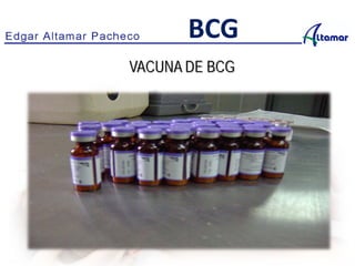VACUNA DE BCG
BCG
 