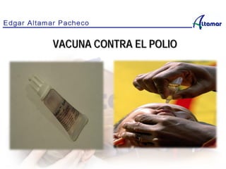 VACUNA CONTRA EL POLIO
 