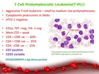Lab Diagnosis of Chronic lymphoproliferative disorders (CLPD ...