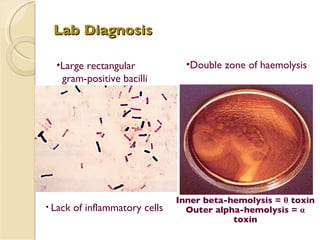 Lab Diagnosis Large rectangular  gram-positive bacilli Inner beta-hemolysis =  θ  toxin Outer alpha-hemolysis =  α  toxin Double zone of haemolysis Lack of inflammatory cells 