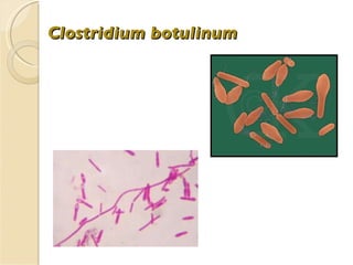 Clostridium botulinum 