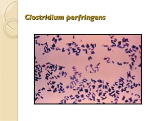 Clostridium perfringens 