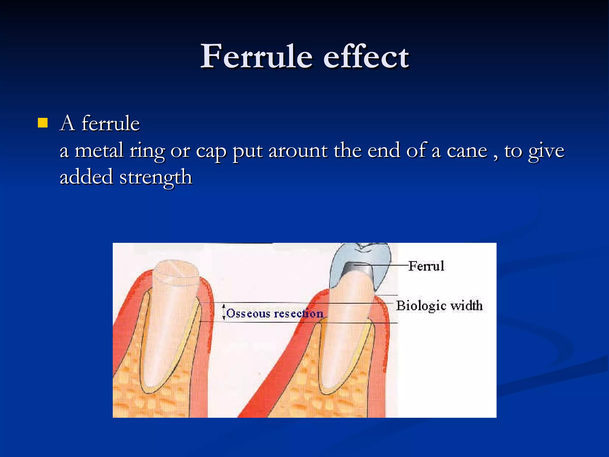 Ferrule effect A ferrule a metal ring or cap put arount the end of a cane , to give added strength 