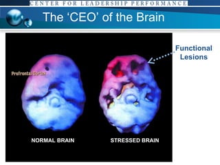 The ‘CEO’ of the Brain NORMAL BRAIN STRESSED BRAIN Functional Lesions 