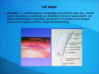 Lid wiper Lid wiper   – ir augšējā plaksta marginālas konjunktīvas daļa, kas   „slauka” (wipe) acs virsmu un pārsedz acs priekšējo virsmu ar asaru plēvīti.  Lid wiper  epiteliopātija ir stāvoklis, kad iekaist un krāsojas ( rose bengal, fluorisceine ) augšēja plaksta margināla konjunktīva. 