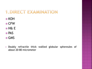  KOH
 CFW
 H& E
 PAS
 GMS
 Doubly refractile thick wallled globular sphereules of
about 20-80 micrometer
 