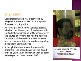 • Coccidioidomycosis was discovered by
Alejandro Posadas in 1891 in a hospital in
Buenos Aries, Argentina.
• He had a patient named Domingo Ezcurra
who had the disease, and Posadas was able
to study the progression of the disease over
the course of 7 years. His head is now the
showpiece of the medical school museum
and has been exhibited at medical mycology
meetings in South America
• Although the disease was discovered in
Argentina, the second case was not found
until 35 years later, and fewer than 30 cases
were reported there before 1967.
 