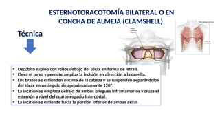 Clase de Anestesia en Cirugia torax. Dr Angulo.pptx