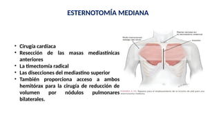 Timectomia Clase de Anestesia en Cirugia torax. Dr Angulo.pptx