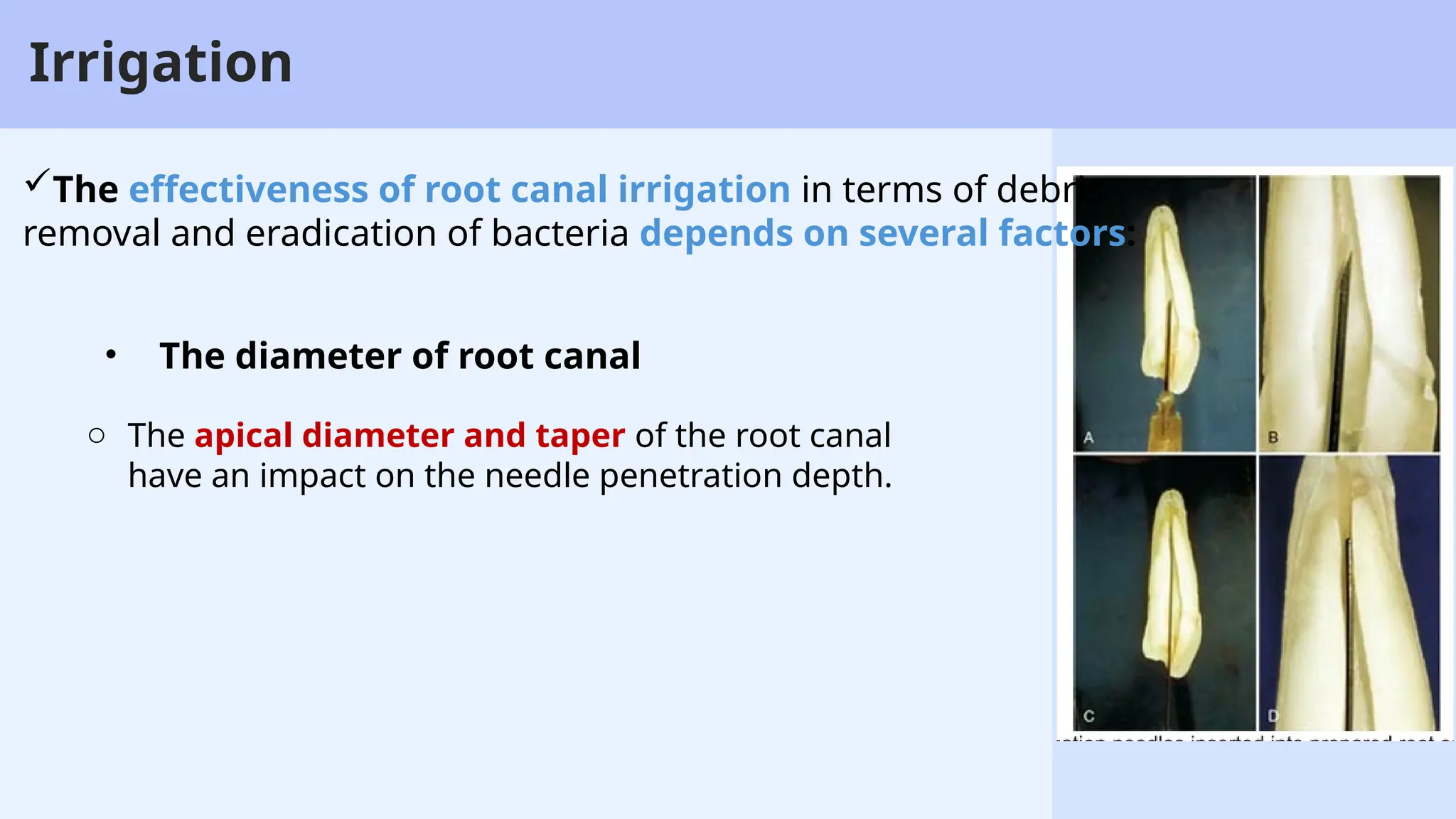 24
Irrigation
• The diameter of root canal
o The apical diameter and taper of the root canal
have an impact on the needle penetration depth.
The effectiveness of root canal irrigation in terms of debris
removal and eradication of bacteria depends on several factors:
 