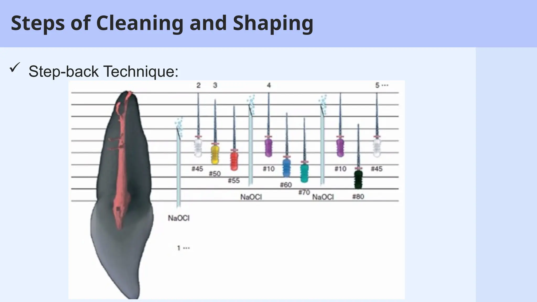 7
Steps of Cleaning and Shaping
 Step-back Technique:
 