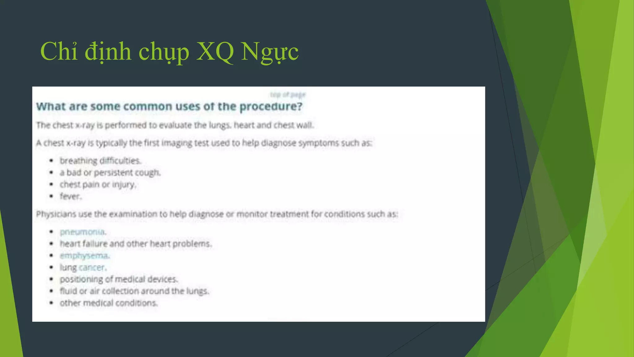 Chỉ định chụp XQ Ngực
 