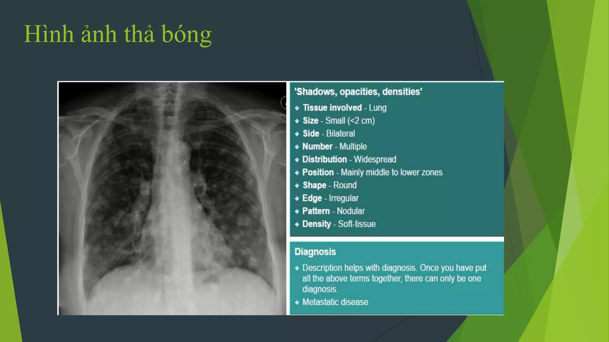 Hình ảnh thả bóng
 