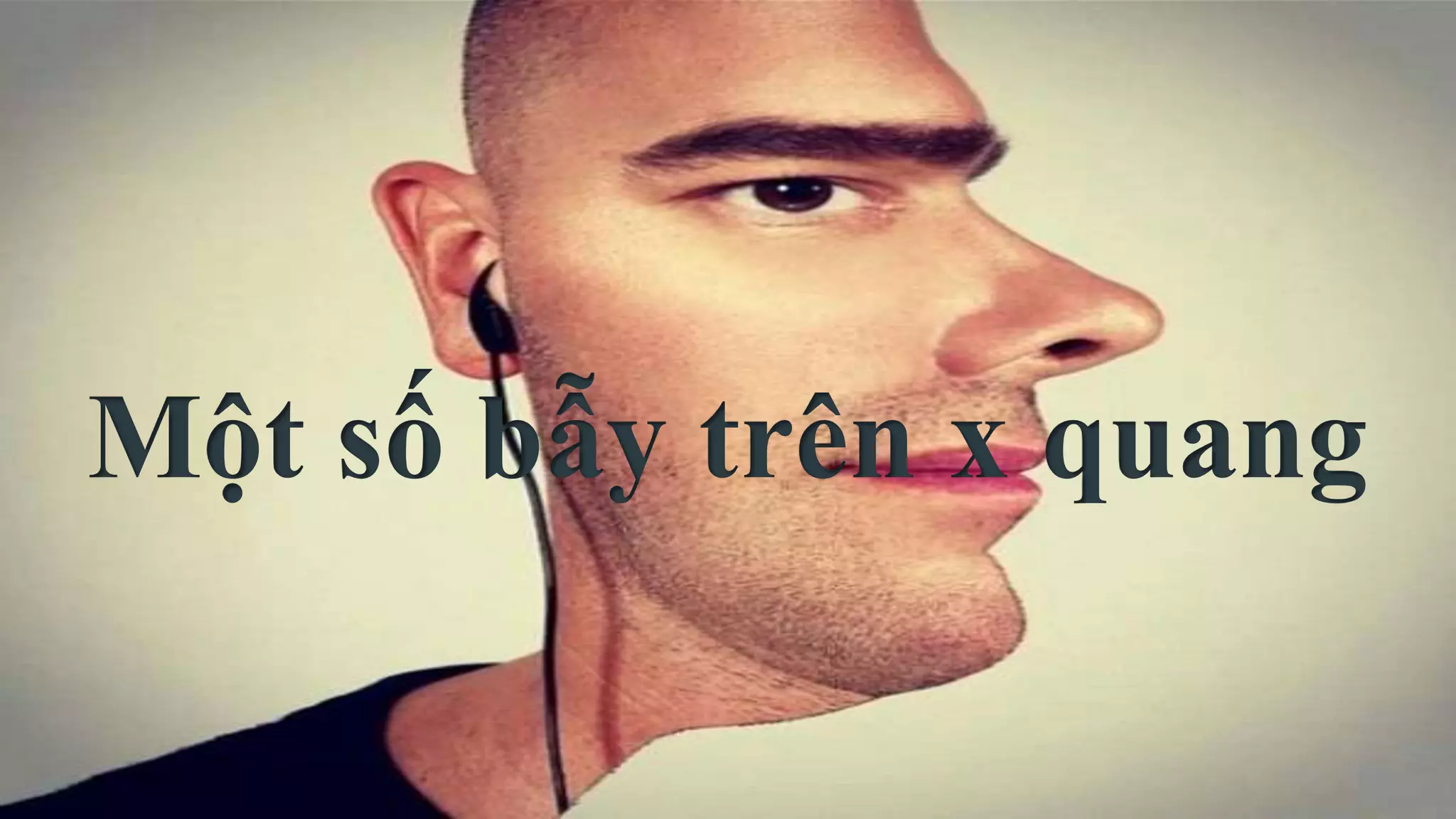 Một số bẫy trên x quang
 