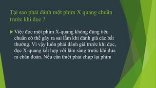 Tại sao phải đánh một phim X quang chuẩn
trước khi đọc ?
 Việc đọc một phim X-quang không đúng tiêu
chuẩn có thể gây ra sai lầm khi đánh giá các bất
thường. Vì vậy luôn phải đánh giá trước khi đọc,
đọc X-quang kết hợp với lâm sàng trước khi đưa
ra chẩn đoán. Nếu cần thiết phải chụp lại phim
 