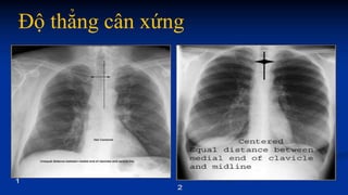 Độ thẳng cân xứng
 