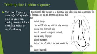 Trình tự đọc 1 phim x quang
 Việc đọc X-quang
theo một thứ tự nhất
định sẽ giúp bạn
đánh giá một cách có
hệ thống, tránh bỏ
sót tổn thương
 