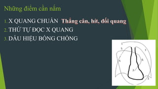 Những điểm cần nắm
1. X QUANG CHUẨN
2. THỨ TỰ ĐỌC X QUANG
3. DẤU HIỆU BÓNG CHỒNG
 