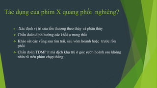 Tác dụng của phim X quang phổi nghiêng?
 Xác định vị trí của tổn thương theo thùy và phân thùy
 Chẩn đoán định hướng các khối u trung thất
 Khảo sát các vùng sau tim trái, sau vòm hoành hoặc trước rốn
phổi
 Chẩn đoán TDMP ít mà dịch khu trú ở góc sườn hoành sau không
nhìn rõ trên phim chụp thẳng
 