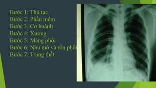 Bước 1: Thủ tục
Bước 2: Phần mềm
Bước 3: Cơ hoành
Bước 4: Xương
Bước 5: Màng phổi
Bước 6: Nhu mô và rốn phổi
Bước 7: Trung thất
 