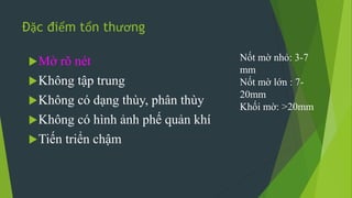 Đặc điểm tổn thương
Mờ rõ nét
Không tập trung
Không có dạng thùy, phân thùy
Không có hình ảnh phế quản khí
Tiến triển chậm
Nốt mờ nhỏ: 3-7
mm
Nốt mờ lớn : 7-
20mm
Khối mờ: >20mm
 