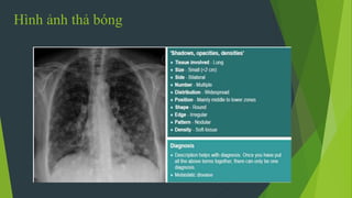 Hình ảnh thả bóng
 