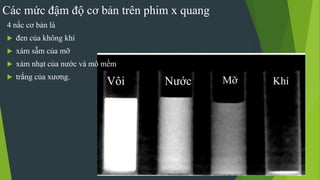 Các mức đậm độ cơ bản trên phim x quang
KhíVôi Nước Mỡ
4 nấc cơ bản là
 đen của không khí
 xám sẫm của mỡ
 xám nhạt của nước và mô mềm
 trắng của xương.
 