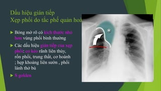 Dấu hiệu gián tiếp
Xẹp phổi do tắc phế quản hoàn toàn
 Bóng mờ rõ có kích thước nhỏ
hơn vùng phổi bình thường
 Các dấu hiệu gián tiếp của xẹp
phổi: co kéo rãnh liên thùy,
rốn phổi, trung thất, cơ hoành
; hẹp khoảng liên sườn , phổi
lành thở bù
 S golden
 