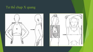 Tư thế chụp X quang
 