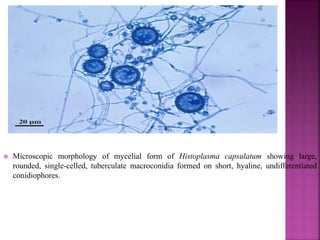  Microscopic morphology of mycelial form of Histoplasma capsulatum showing large,
rounded, single-celled, tuberculate macroconidia formed on short, hyaline, undifferentiated
conidiophores.
 