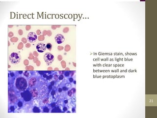 Direct Microscopy…
In Giemsa stain, shows
cell wall as light blue
with clear space
between wall and dark
blue protoplasm
21
 