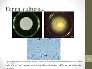 Fungal culture…
24
Ref. :American Academy of Pediatrics, Red book: 2012. Report of the committee on infectious Diseases. Pickerine LK, ed.29th ed. Elk
Grobe Village, IL
 On SDA at 250C, colonies are initially white (albino) or buff brown with fine arial
 