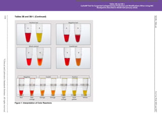 M100,
30th
ed.
For
Use
With
M02
and
M07
116
©
Clinical
and
Laboratory
Standards
Institute.
All
rights
reserved
.
Tables 3B and 3B-1. (Continued)
Figure 1. Interpretation of Color Reactions
Tables 3B and 3B-1
CarbaNP Test for Suspected Carbapenemase Production and Modifications When Using MIC
Breakpoints Described in M100-S20 (January 2010)
CLSI
eCLIPSE
-
Dewanand
Mahto
-
BD
-
01/29/2020.
Unauthorized
duplication
or
network
sharing
is
not
allowed.
 