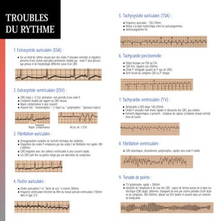 5. Tachysystolie auriculaire (TSA) :
•Fréquence auriculaire : 130-210/mn,
•Retour à la ligne isoélectrique entre les auriculogrammes,
•Ventriculogramme fin.
6. Tachycardie jonctionnelle :
•Début brusque sur ESA ou ESV,
•QRS fins, réguliers vers 200/mn,
•Onde P’ rétrograde (autant de P’ que de QRS),
•Arrêt brutal du complexe QRS ou P’ bloqué.
7. Tachycardie ventriculaire (TV) :
•Tachycardie à QRS larges 140-220/mn,
•Ondes P sinusales mais moins rapides et dissociées des QRS, peu visibles,
•Eléments diagnostiques si présents : complexe de capture (complexe sinusal normal)
et/ou de fusion.
8. Fibrillation ventriculaire :
•QRS anarchiques, désordonnés, polymorphes, rapides sans onde P visible.
9. Torsade de pointe :
•TV polymorphe, rapide > 200/mn,
•Variation de l’amplitude et de l’axe des QRS : aspect de torsion autour de la ligne iso-
électrique (QRS larges, déformés, changeant de sens par courtes périodes d’une dizai-
ne de complexes, 200-250/mn), débute sur ESV tardive et souvent dans un contexte
de bradycardie.
1. Extrasystole auriculaire (ESA) :
•Sur un fond de rythme sinusal avec des ondes P sinusales normales et régulières
présence d’une systole auriculaire prématurée notable par : onde P’ plus précoce
que prévue et de morphologie différente suivie d’un QRS.
2. Extrasystole ventriculaire (ESV) :
•QRS élargi (> 0,12s), prématuré, non précédé d’une onde P,
•Complexe variable par rapport au QRS sinusal,
•Repos compensateur le plus souvent,
•Peuvent être " monomorphes " (1 foyer) ou " polymorphes " (plusieurs foyers).
3. Fibrillation auriculaire :
•Désorganisation complète de l’activité électrique des oreillettes,
•Disparition des ondes P remplacées par des ondes f de fibrillation très rapide, 400
à 600/mn,
•QRS irréguliers avec une cadence ventriculaire le plus souvent rapide,
•Les QRS sont fins ou parfois élargis par une aberration de conduction.
4. Flutter auriculaire :
•Ondes auriculaires F en "dents de scie" à environ 300/mn,
•Fréquence ventriculaire fonction du filtre du noeud auriculo-ventriculaire (150/mn
dans le type 2/1).
TROUBLES
DU RYTHME
1. Signes électrocardiographiques :
Ischémie.
•Soit sous-épicardique : onde T négative,
symétrique et pointue.
•Soit sous-endocardique : onde T positive,
symétrique et pointue.
Lésion.
•Soit sous-endocardique :
sous-décalage de ST > 1mn.
•Soit sous-épicardique : sus-décalage de ST.
Nécrose constituée.
•Onde Q large (> 0,04 s)
et profonde.
2. Signes de localisation :
1 : postéro-inférieur ou inférieur : D2, D3, VF
2 : antéro-septal : V1, V2, V3
3 : latéral : D1, VL, V5, V6
4 : latéral haut : VL, D1
5 : apical : V4 (micro-voltage)
Extension VD : V3R V4R
INSUFFISANCE
CORONARIENNE
6 : basal ou postérieur vrai :
V7, V8, V9
1+2 : septal profond
1+3 : postéro-latéral
2+3+5 : antérieur étendu
Repos compensateur Accès de 3 ESV
Environ
4 mm.
Largeur 1 mm
1
3
OU
de la hauteur de QRS
 