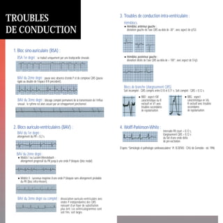3. Troubles de conduction intra-ventriculaire :
Hémiblocs.
•Hémibloc antérieur gauche :
déviation gauche de l’axe QRS au-delà de -30°, avec aspect de q1S3.
•Hémibloc postérieur gauche :
déviation droite de l’axe QRS au-delà de + 100°, avec aspect de S1q3.
Blocs de branche (élargissement QRS)
Soit incomplet : QRS compris entre 0,10 et 0,11 s. Soit complet : QRS > 0,12 s.
4. Wolff-Parkinson-White :
Intervalle PR court < 0,12 s,
Elargissement QRS > 0,12 s
du fait d’une onde delta
de pré-excitation.
D’après “Sémiologie et pathologie cardiovasculaires” Pr. B.DENIS - CHU de Grenoble - éd. 1996
TROUBLES
DE CONDUCTION
1. Bloc sino-auriculaire (BSA) :
BSA 1er degré : se traduit uniquement par une bradycardie sinusale.
BAV du 2ème degré : pause avec absence d’onde P et de complexe QRS (pause
égale au double de l’espace R-R précédent).
BAV du 3ème degré : blocage complet permanent de la transmission de l’influx
sinusal ; le rythme est alors assuré par un échappement jonctionnel.
2. Blocs auriculo-ventriculaires (BAV) :
BAV du 1er degré :
allongement du PR > 0,2 s.
BAV du 2ème degré :
•Mobitz I ou Luciani-Wenckebach :
allongement progressif du PR jusqu’à une onde P bloquée (bloc nodal).
•Mobitz II : survenue inopinée d’une onde P bloquée sans allongement préalable
du PR (bloc infra-Hissien).
BAV du 3ème degré ou complet : dissociation auriculo-ventriculaire avec
ondes P indépendantes des QRS
naissant d’un foyer de substitution
plus lent. Les ventriculogrammes sont
soit fins, soit larges.
•BBD : aspect rSR’
caractéristique ou R
exclusif en V1 avec
troubles secondaires
de repolarisation.
•BBG : aspect
caractéristique en V6,
R exclusif avec troubles
secondaires
de repolarisation.
Les clés
de la lecture
ECG
 