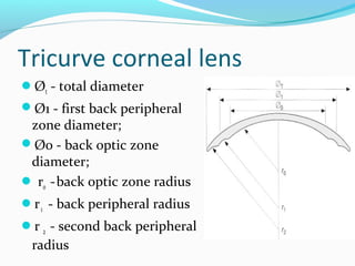 R R1 R2 Radiius Optics contact lens material | PPT