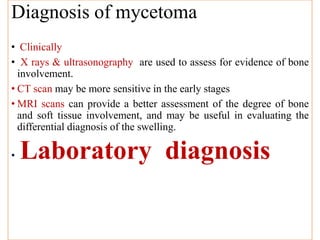 Diagnosis
Diagnosis of mycetoma
• Clinically
• X rays & ultrasonography are used to assess for evidence of bone
involvement.
• CT scan may be more sensitive in the early stages
• MRI scans can provide a better assessment of the degree of bone
and soft tissue involvement, and may be useful in evaluating the
differential diagnosis of the swelling.
• Laboratory diagnosis
 