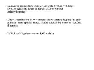 • Eumycotic grains show thick 2-6um wide hyphae with large
swollen cells upto 15um at margin with or without
chlamydospores
• Direct examination in wet mount shows septate hyphae in grain
material then special fungal stains should be done to confirm
diagnosis
• In PAS stain hyphae are seen PAS positive
 