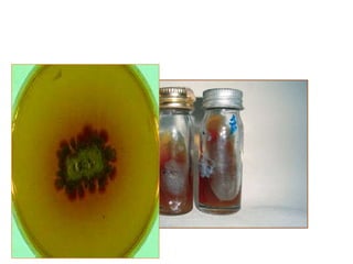 Madurella mycetomatis in Sabouraud's dextrose
agar with brown pigment
 