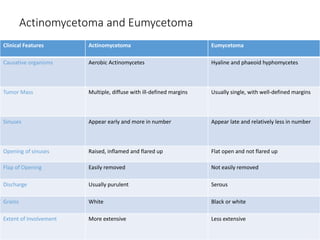 Actinomycetoma and Eumycetoma
Clinical Features Actinomycetoma Eumycetoma
Causative organisms Aerobic Actinomycetes Hyaline and phaeoid hyphomycetes
Tumor Mass Multiple, diffuse with ill-defined margins Usually single, with well-defined margins
Sinuses Appear early and more in number Appear late and relatively less in number
Opening of sinuses Raised, inflamed and flared up Flat open and not flared up
Flap of Opening Easily removed Not easily removed
Discharge Usually purulent Serous
Grains White Black or white
Extent of Involvement More extensive Less extensive
 