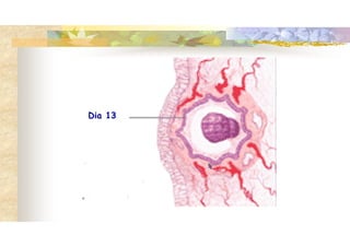 Dia 13
 