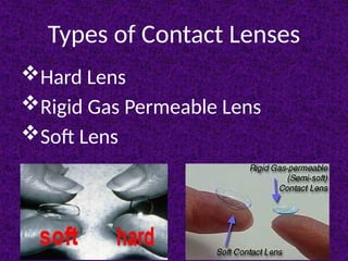 fot the optometry studies the CL TYPES.pptx