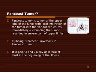 Pancoast Tumor?Pancoast tumor is tumor of the upper lobe of the lungs with local infiltration of the tumor into the various structures immediately surrounding the tumor resulting in severe pain of upper limbsClubbing is present universally in Pancoast tumor It is painful and usually unilateral at least in the beginning of the illness23
